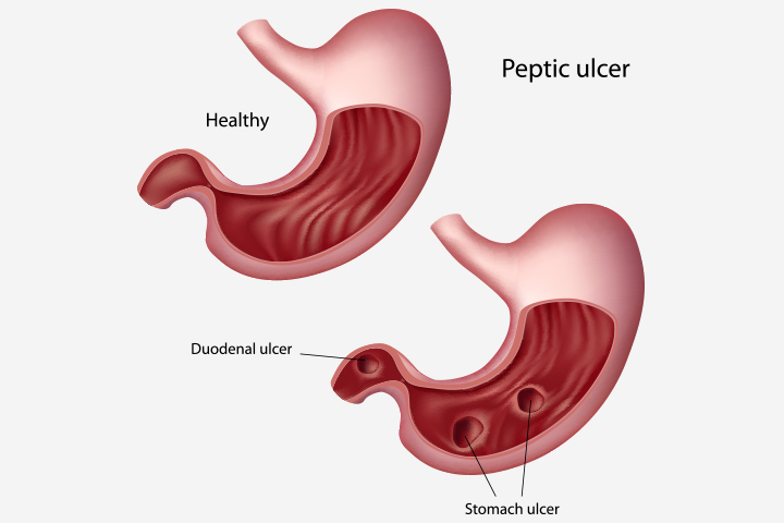 STFORM - STOMACH HERBAL - Image 2