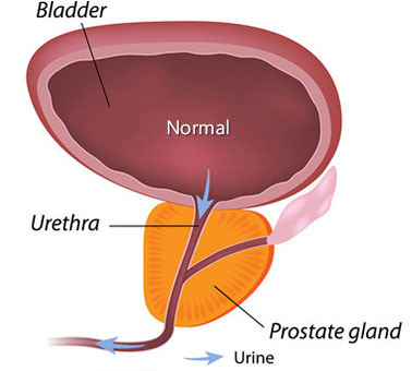 PRSFORM - PROSTATE HEALTH - Image 3