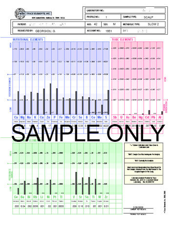 HMD® HAIR MINERAL ANALYSIS & TOXIC METALS TEST - Image 2