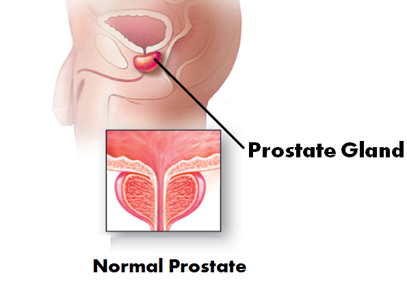 PRSFORM - PROSTATE HEALTH - Image 2