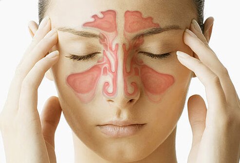 SNFORM - SINUS HERBAL FORMULA - Image 3