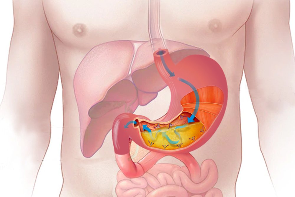 STFORM - STOMACH HERBAL - Image 3